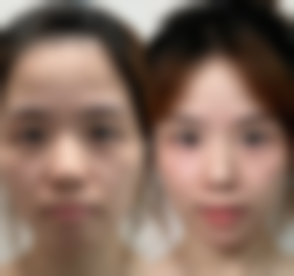 权伍仲医生的专精技术优势