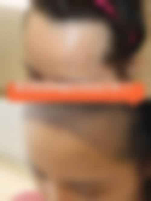 徐州高第植发医院医生团队实力