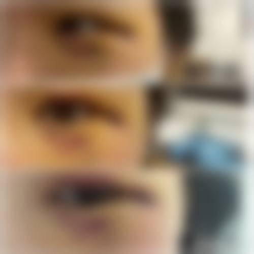 孙豪成医生的实例成果