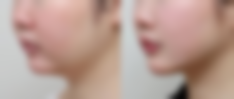 宜宾蜜拉贝儿（宜尔美）医疗美容门诊部怎么样医生团队实力