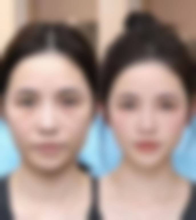 宜昌伊星整形医院怎么样价格收费