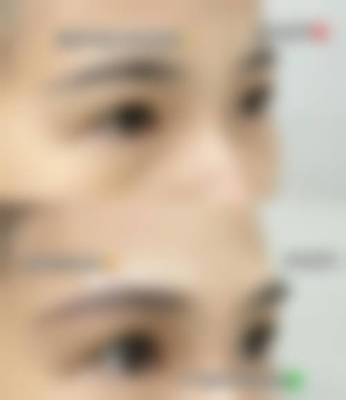 选择杨顺新医生的理由