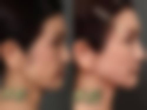 西宁友健整形医院怎么样特色项目及技术优势