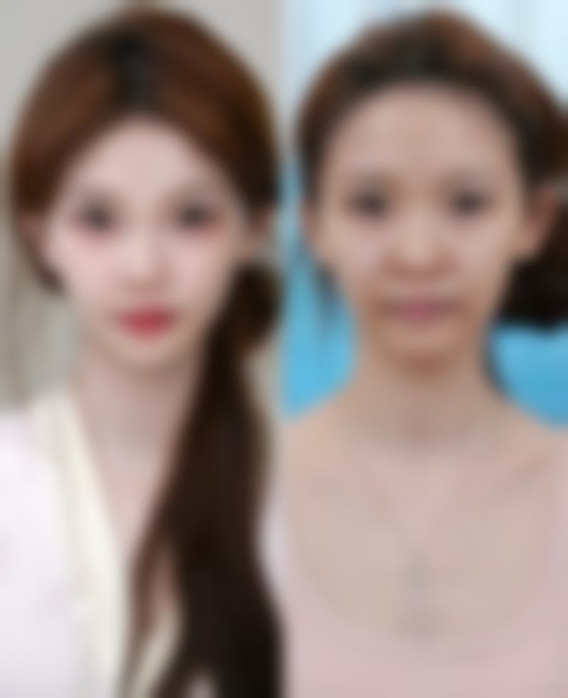 阜阳微悦整形医院怎么样医生团队实力