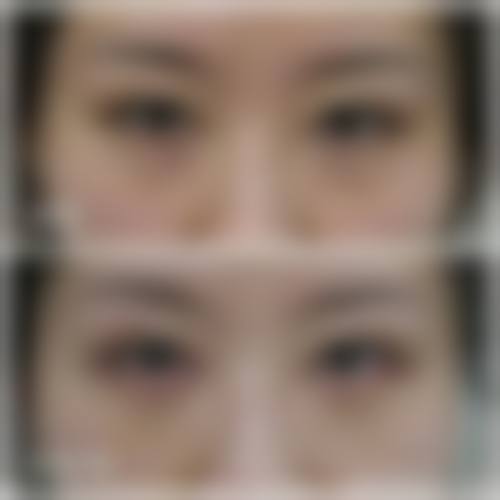 石家庄WT韩式半恒久定妆中 心价格收费