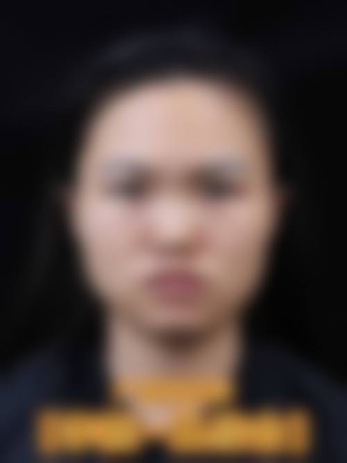 吴宰阭院长的求美者服务理念