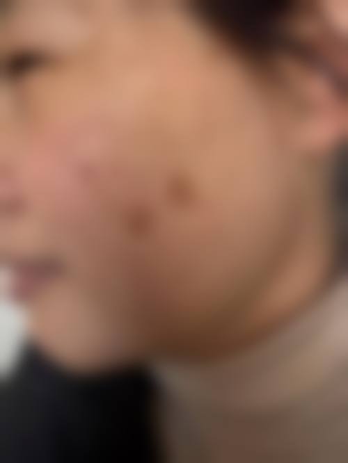 fido Skin Clinic求美者反馈