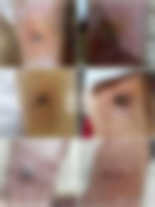 西安安康永秀整形医疗美容门诊部怎么样价格收费