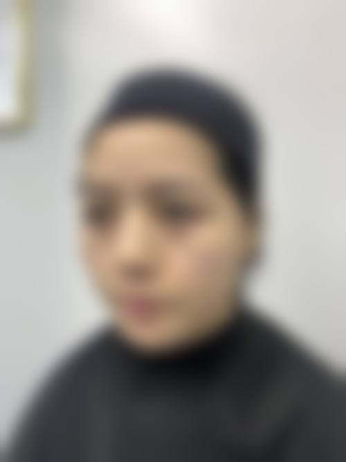 李俊浩院长的特色精细化医美技术