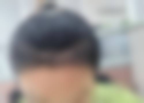 闵成基医生诊疗全程的安心保护