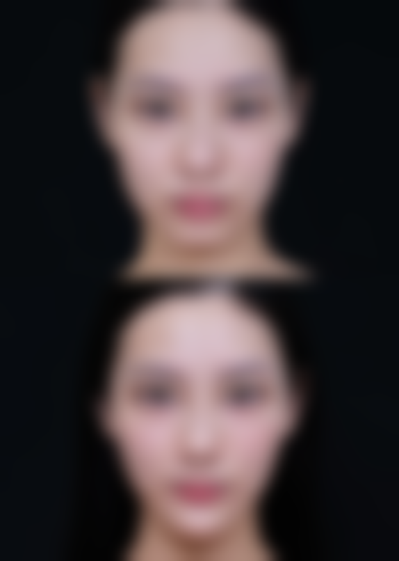 求美者真实反馈