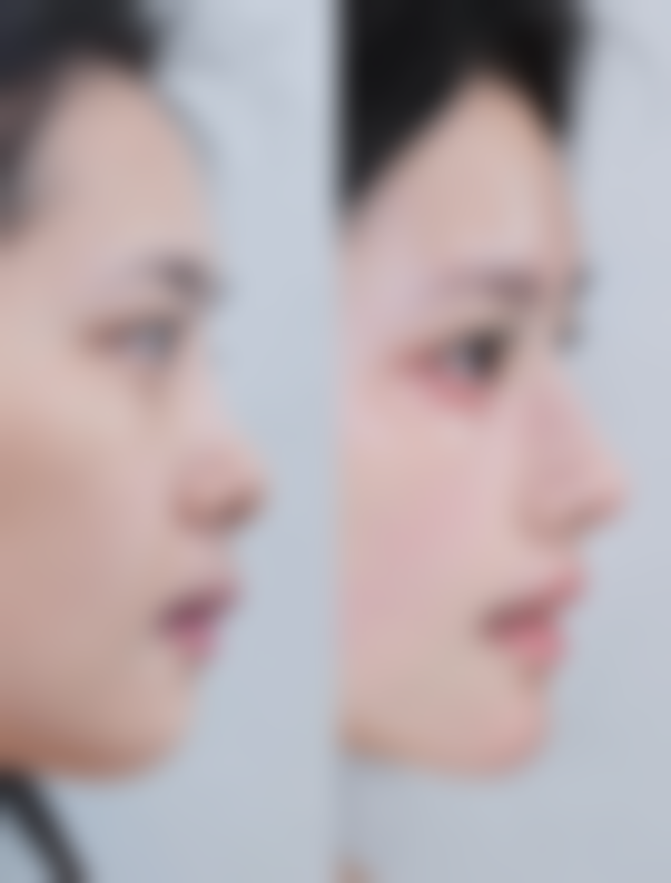 预约李在承院长面诊的便捷方式