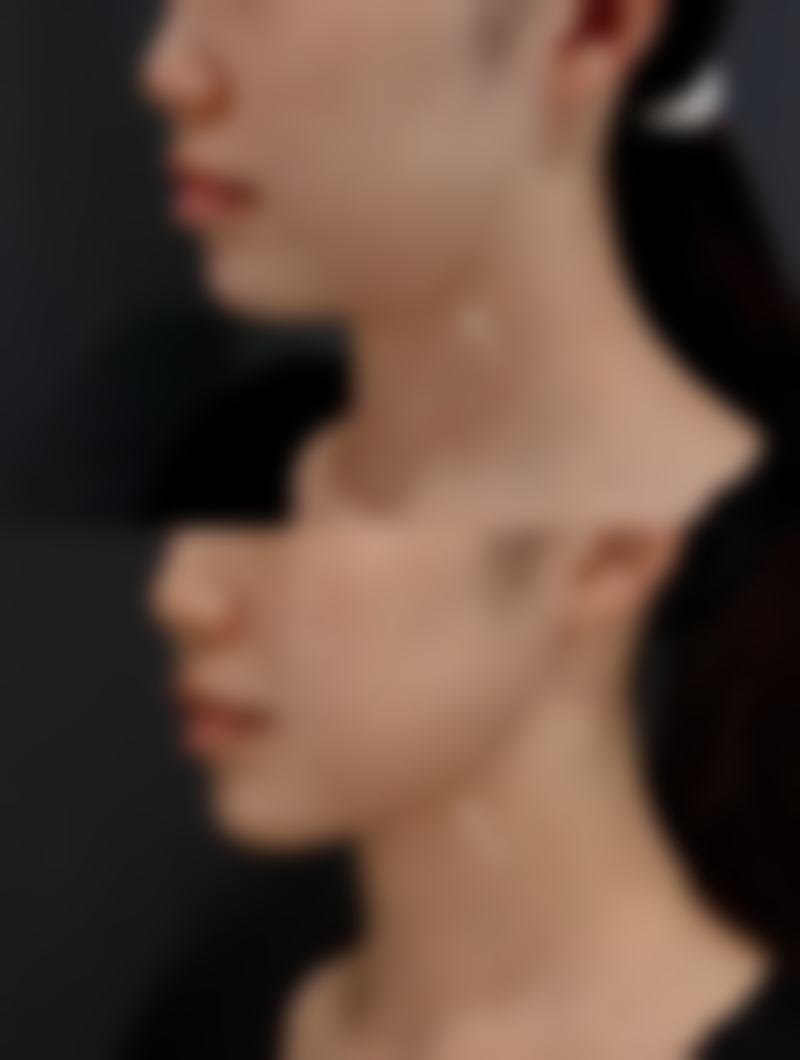 雅阁整形外科价格收费