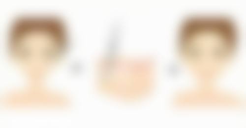 徐勇军 医生的诊疗技术特色