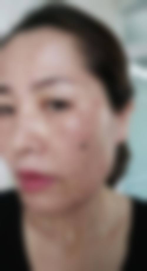 荆州洪湖现代整形医疗美容诊所求美者反馈