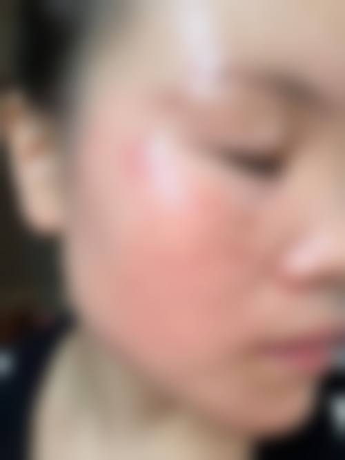 荆州洪湖现代整形医疗美容诊所价格收费