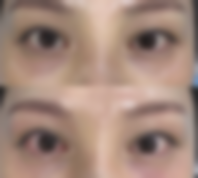 江燕践行的**精细化个性化医美技术**塑造自然理想成效