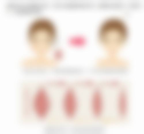 温州佳人汇医疗美容诊所价格收费