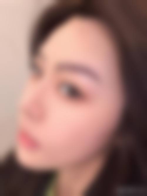 郑支恩可开展的五大类合规医美项目