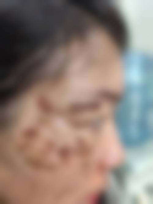 厦门思明莫琳娜医疗美容门诊部求美者反馈