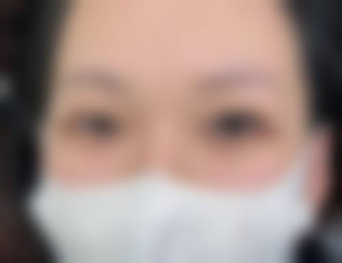 吴宰阭院长的精细化医美操作特色