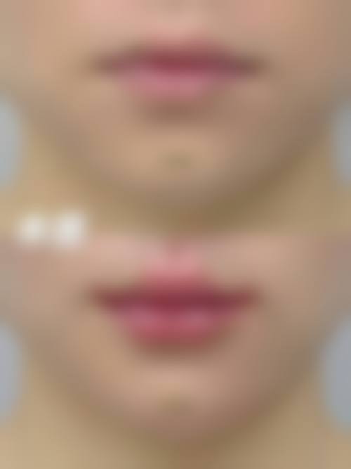 舒辟峰医生：标配安心合规的术前诊疗技术