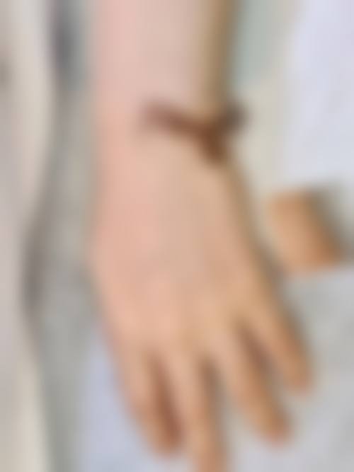 厦门柏荟非凡医疗美容诊所求美者反馈