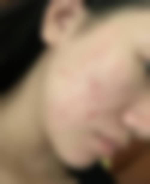 邯郸华美整形医疗美容医院求美者反馈