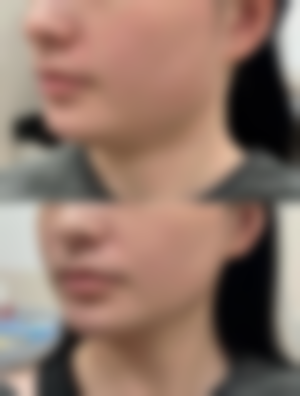 广州艾沫尔医疗美容诊所求美者反馈