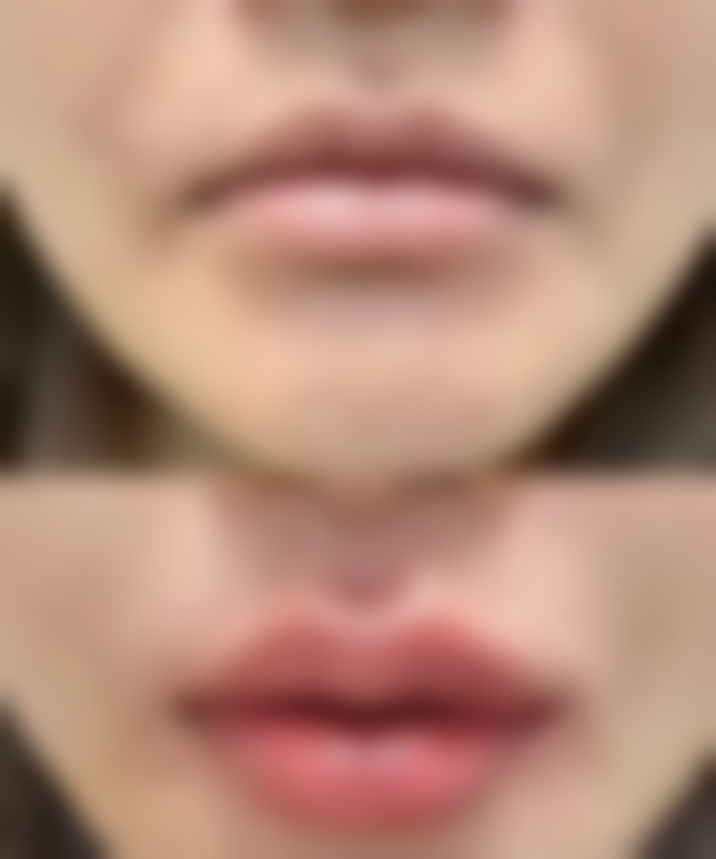 恩施利川仁爱医学美容门诊部特色项目及技术优势