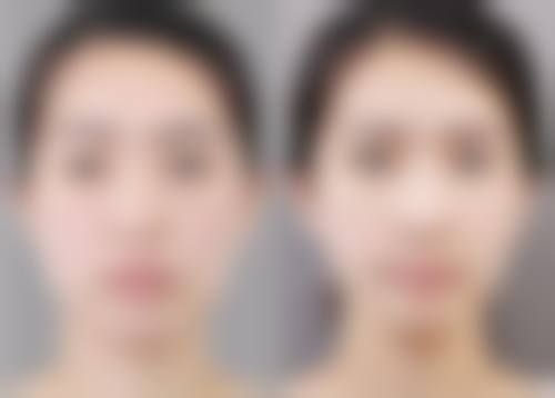 湖北省第三人民医院医学美容科价格收费