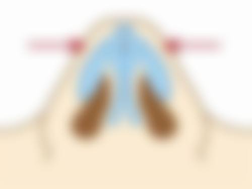 便捷预约曹振湘医师，轻松开启变得更美之旅