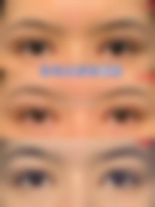 湖北省第三人民医院医学美容科特色项目及技术优势