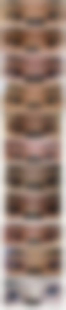 佛山高明人民医院烧伤整形外科求美者反馈