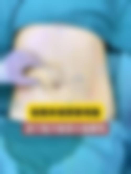 山东丽港美容整形医院特色项目及技术优势