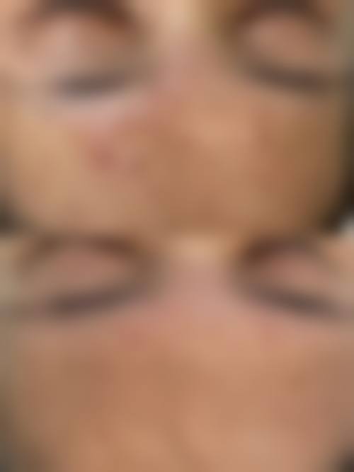 桂林新华整形美容诊所价格收费