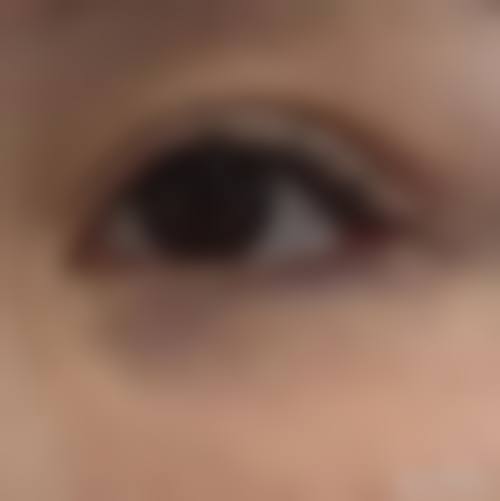 佛山高明人民医院烧伤整形外科特色项目及技术优势