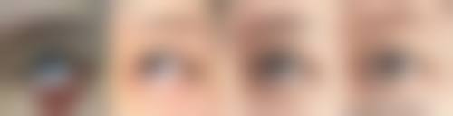 佛山高明人民医院烧伤整形外科价格收费