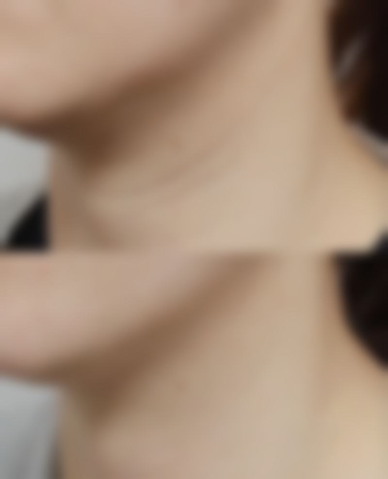 杭州伊甸媛医疗美容价格收费