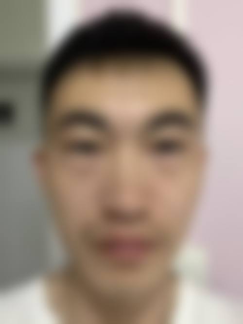 青岛诺美德整形医院求美者反馈