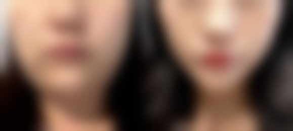 李在承院长所在的韩国INFINI整形外科区位