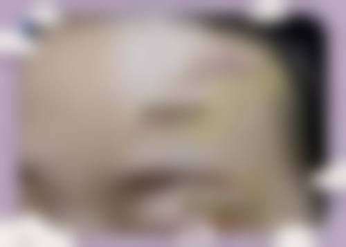 连云港市第一人民医院(烧伤整形科)怎么样基本信息