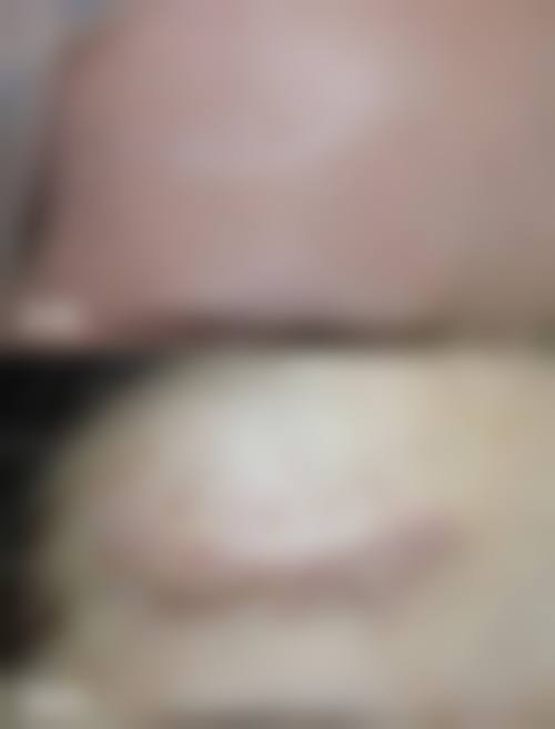 连云港市第一人民医院(烧伤整形科)怎么样特色项目及技术优势