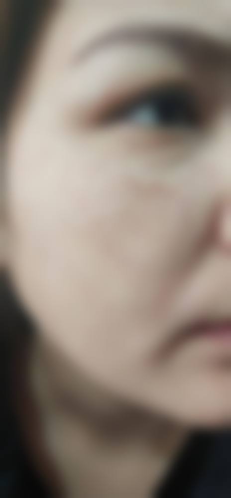 庄雅丹医生：搭配精良设备实现精细化医美操作