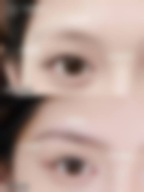 连云港市第一人民医院(烧伤整形科)怎么样价格收费