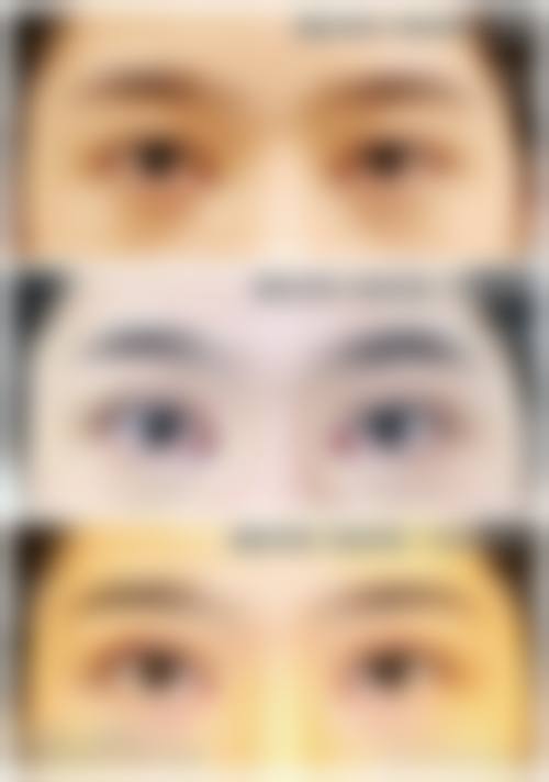 武汉阿芙罗整形医院怎么样价格收费