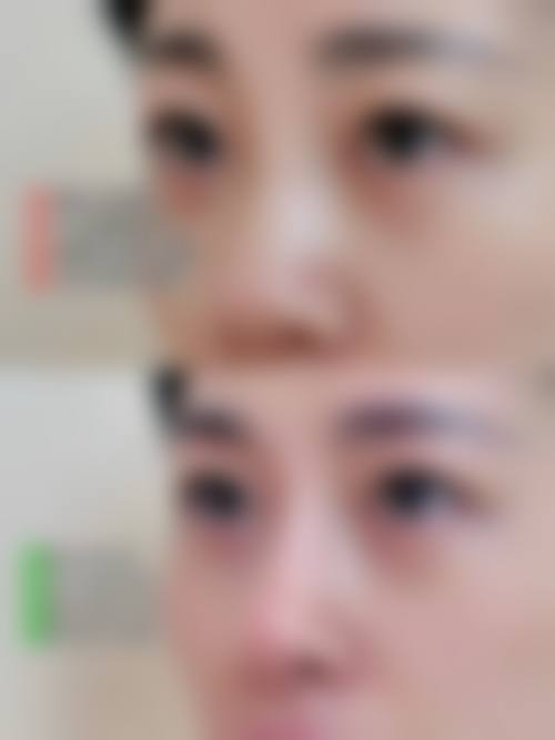 选择闵成基医生的专属就医体验