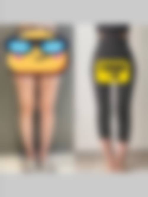 韩国Newstar Clinic整形外科价格收费