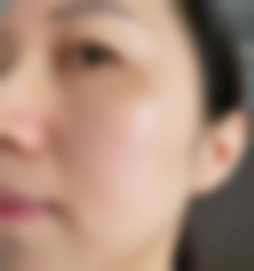 北京壹可唯医疗美容诊所求美者反馈