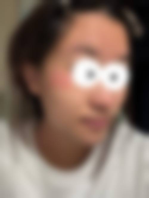 宿迁宝禾整形医院特色项目及技术优势